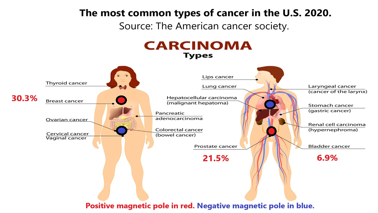 The common types of cancer in the U.S. 2020.
