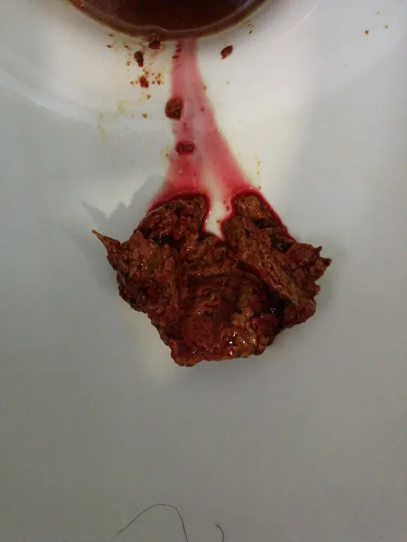 Liver cysts and rotted digestive tissues.