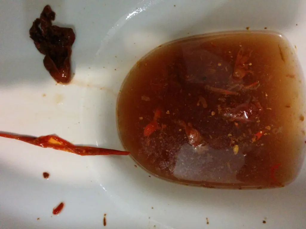 Worms