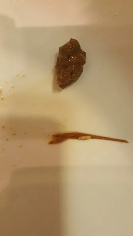 Worms