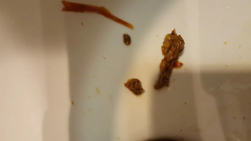 Worms