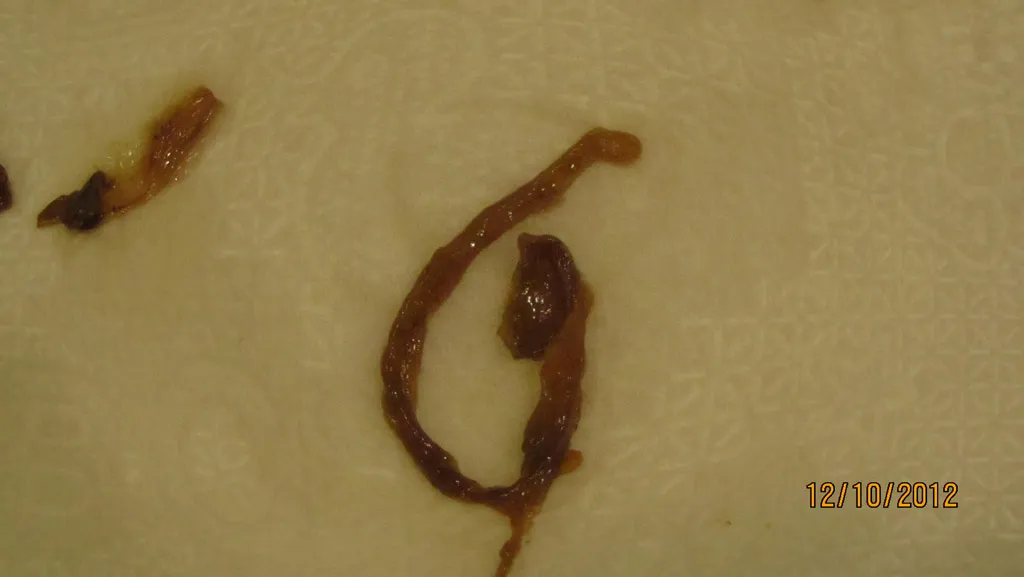 Worms