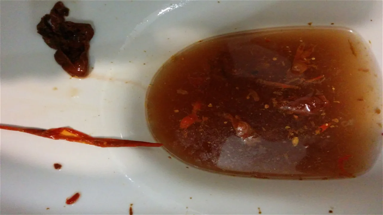 Giant Liver Fluke Worms - Removed by liver flushes & Coffee & Baking soda enemas.