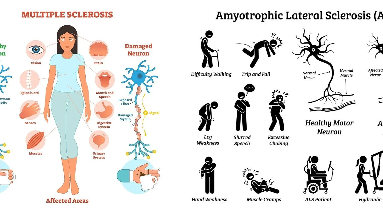 MS and ALS rehabilitation using self-healing medicine.