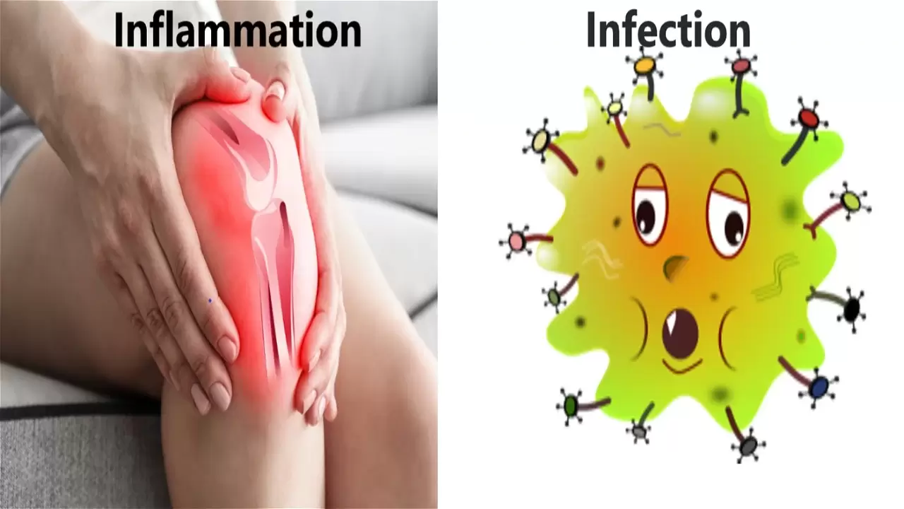 Inflammation vs. infection.