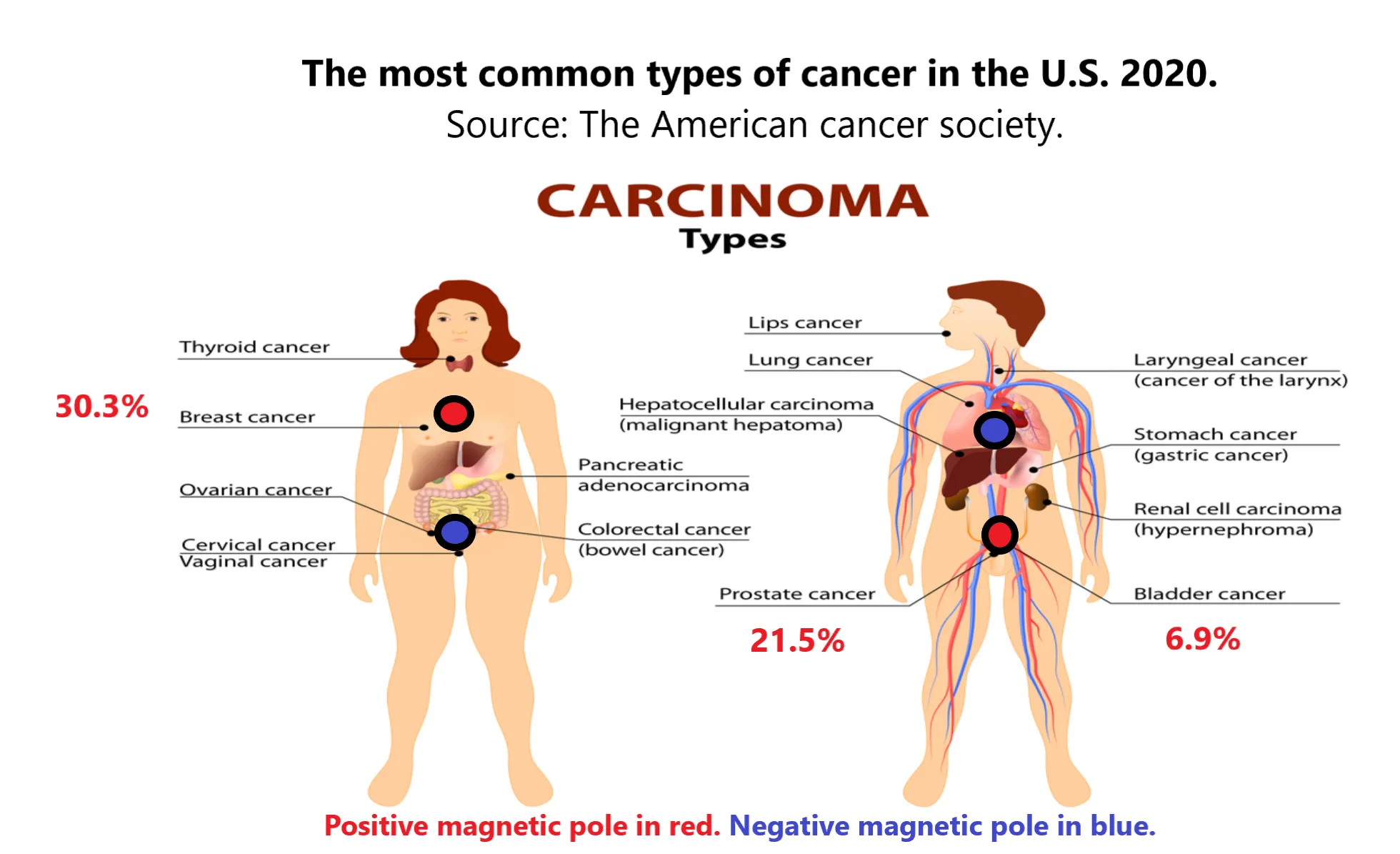 The common types of cancer in the U.S. 2020.
