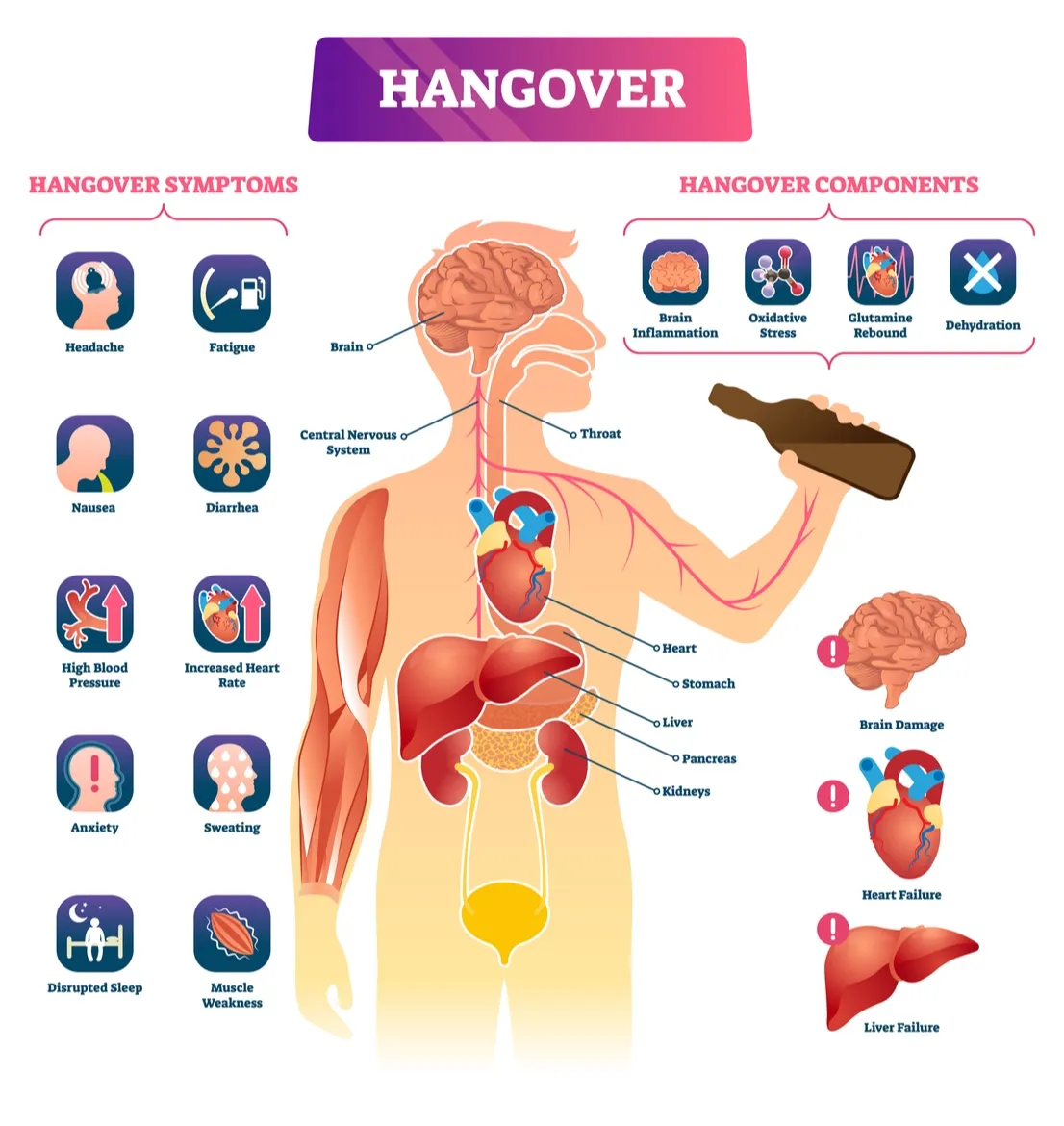 Alcohol Use Disorder. (AUD)