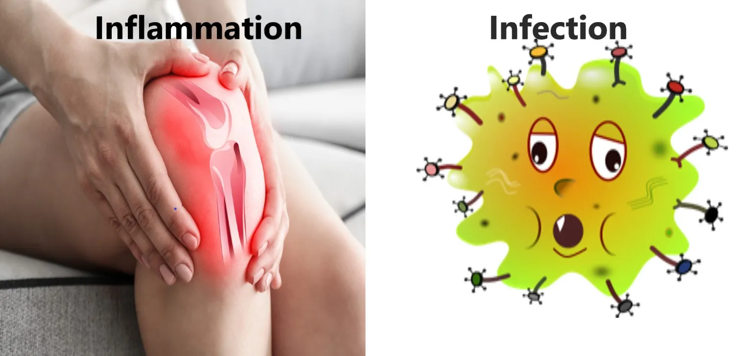 Inflammation vs. Infection. (Often confused.)