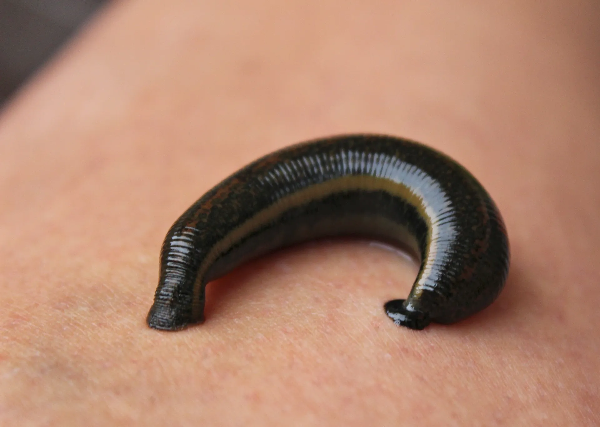 Medical leeches. (Not a Chinese therapy)